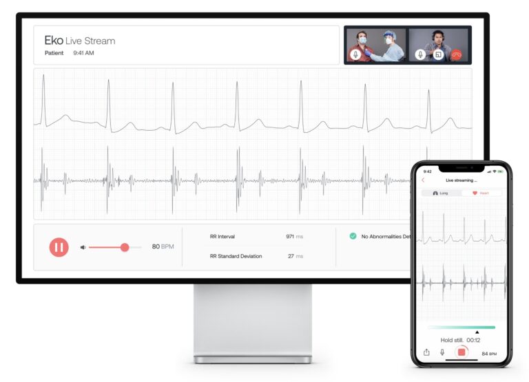 Eko-Livestreaming